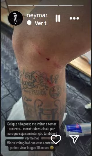 Neymar perna stories pessoal