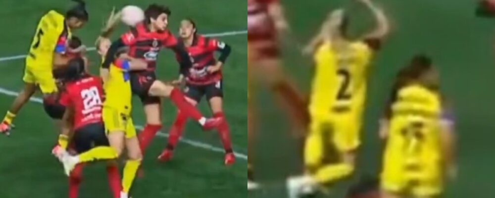 Ex-estrela do Cruzeiro fratura nariz após levar cotovelada com 14 minutos de jogo