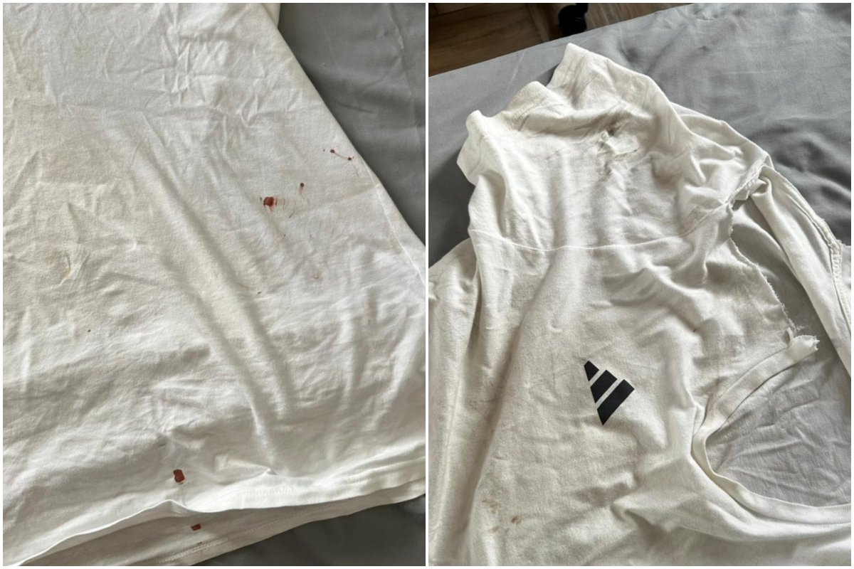 O estado da camisa de Guilherme Nunes depois de ser agredido na Arena MRV - (foto: Imagens cedidas ao No Ataque)